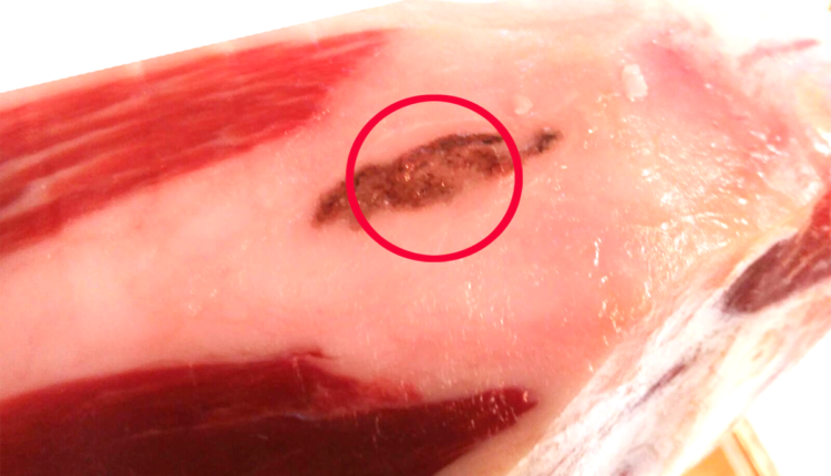 linfonodulos-nodulos-linfaticos-jamon